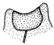 False Indusium Saddle Margin